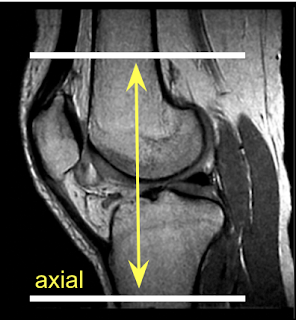 Axial