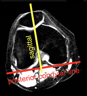 Knee_Sagittal