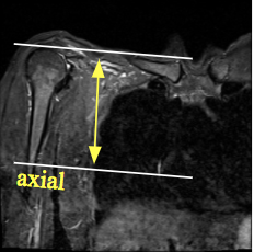 Pec_Axial