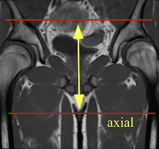 SH_axial