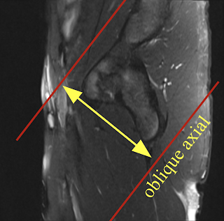 SH_obl_axial