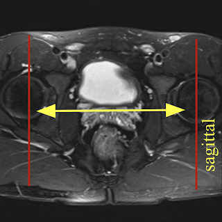 SH_sagittal